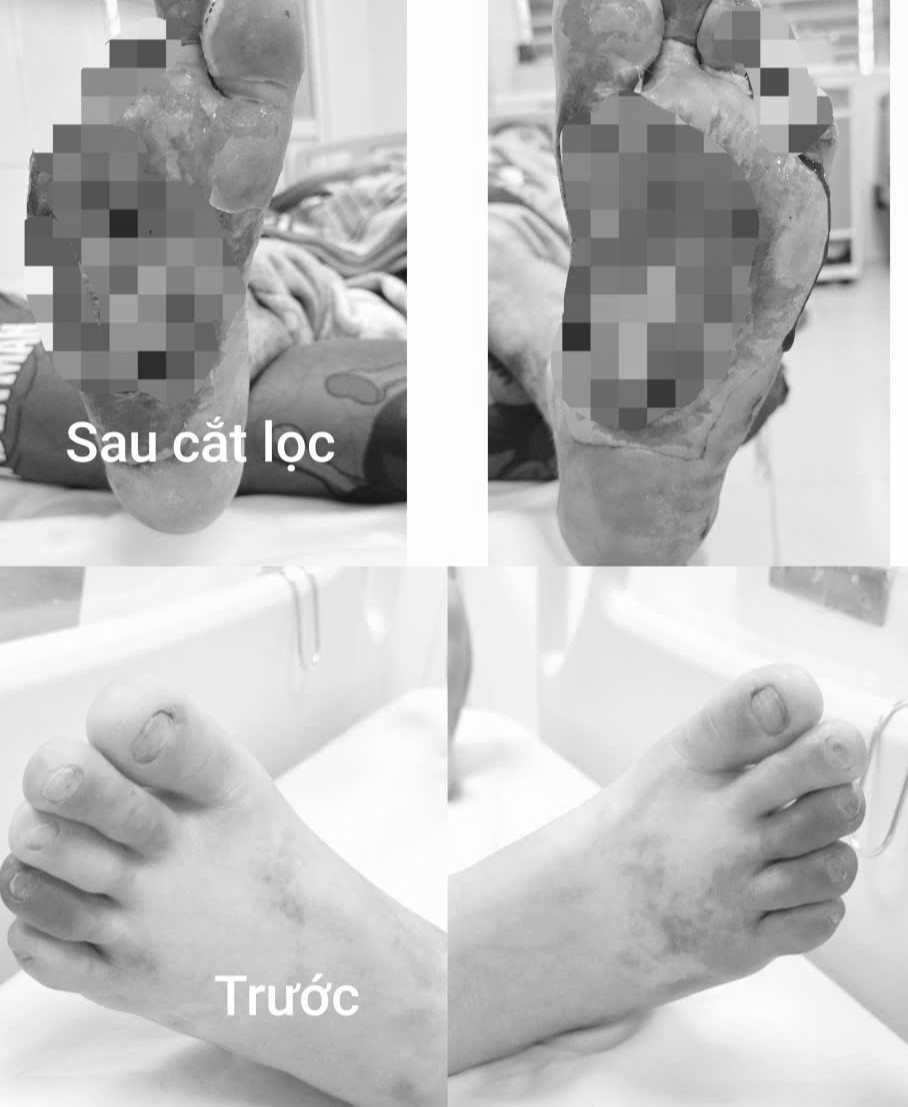 nhiễm tr&ugrave;ng ảnh 2