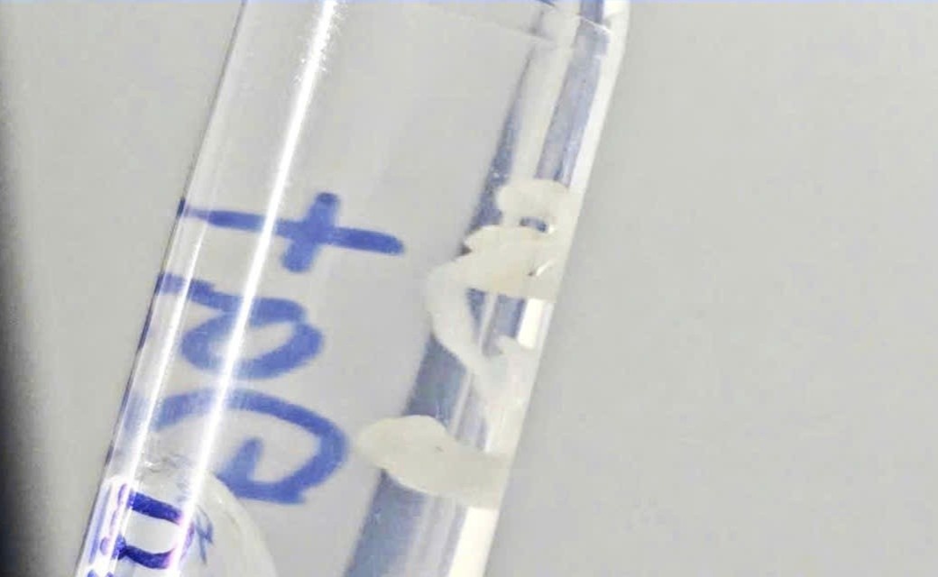 ấu tr&ugrave;ng ảnh 1