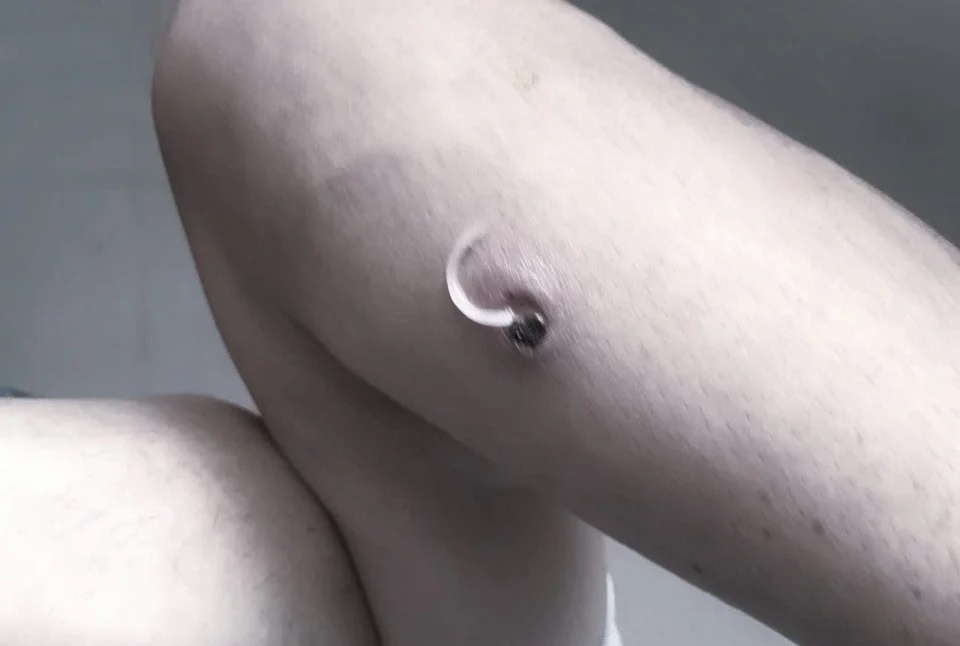 Loài giun có cách lây lan gây đau đớn, nguy hiểm khi tự ý rút ra