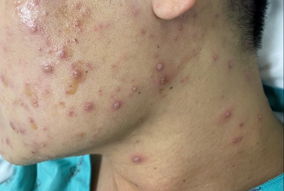 truyền nhiễm ảnh 1