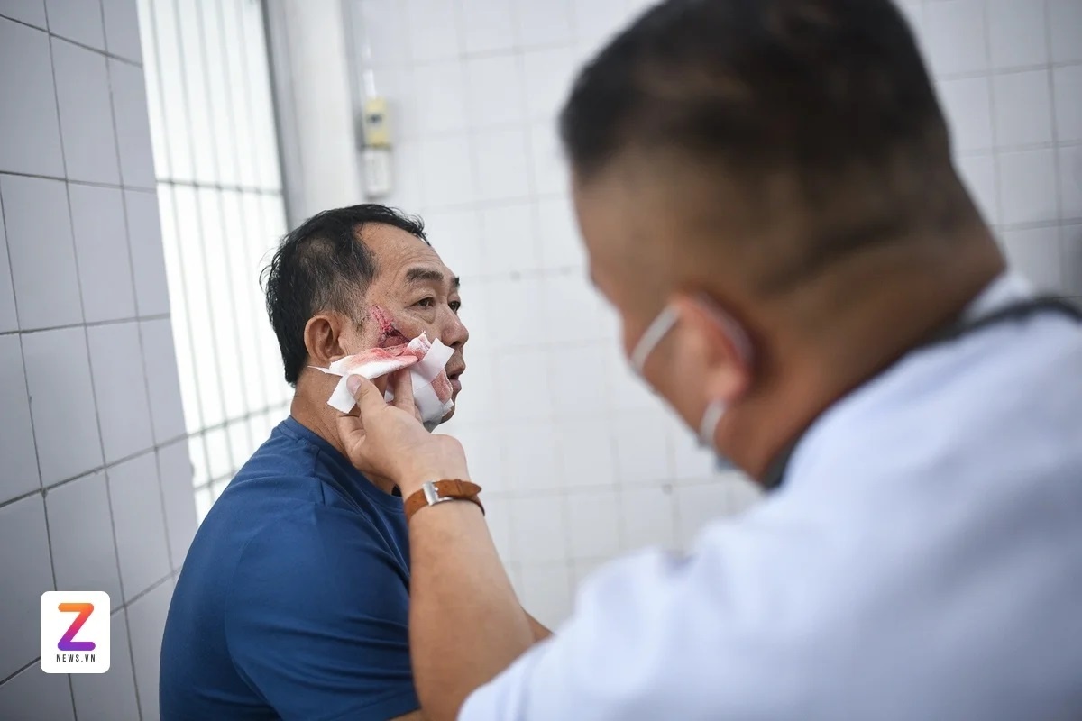 bệnh dại ảnh 2