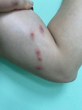 bọ ch&eacute;t ảnh 2
