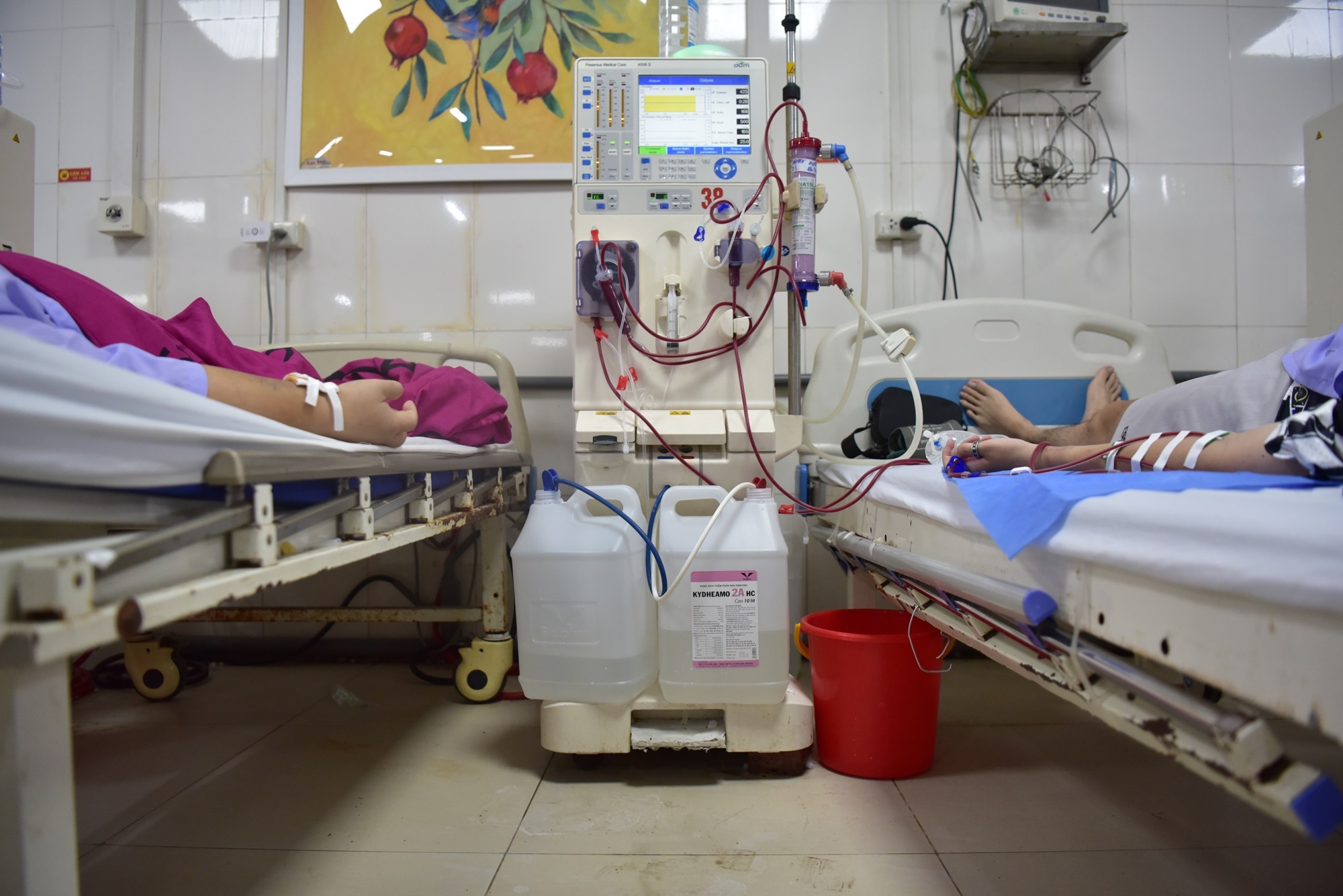 Suy thận ảnh 2