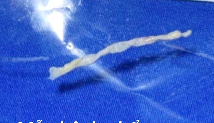 K&yacute; sinh tr&ugrave;ng  ảnh 2