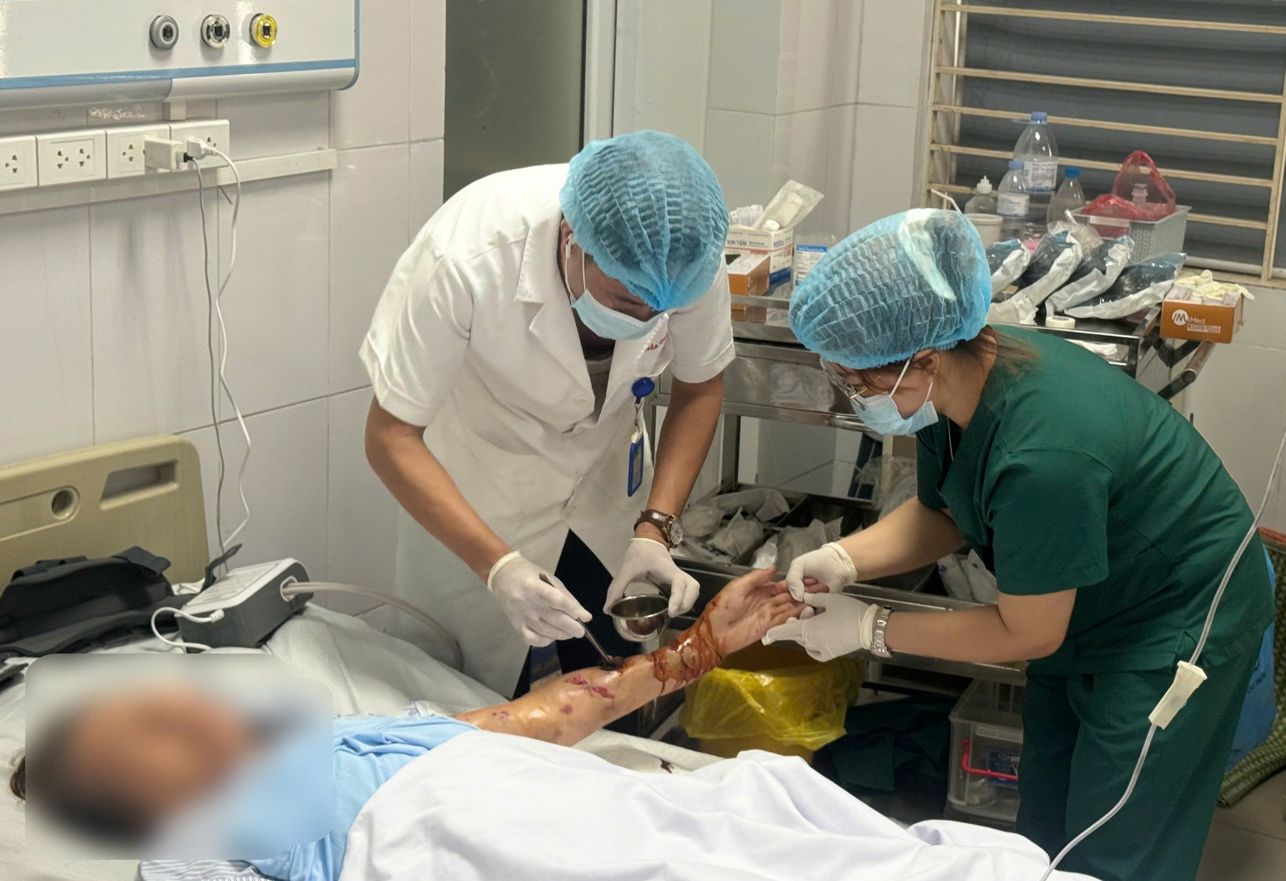 Hai người bị chó nhà tấn công với vết thương kinh hoàng