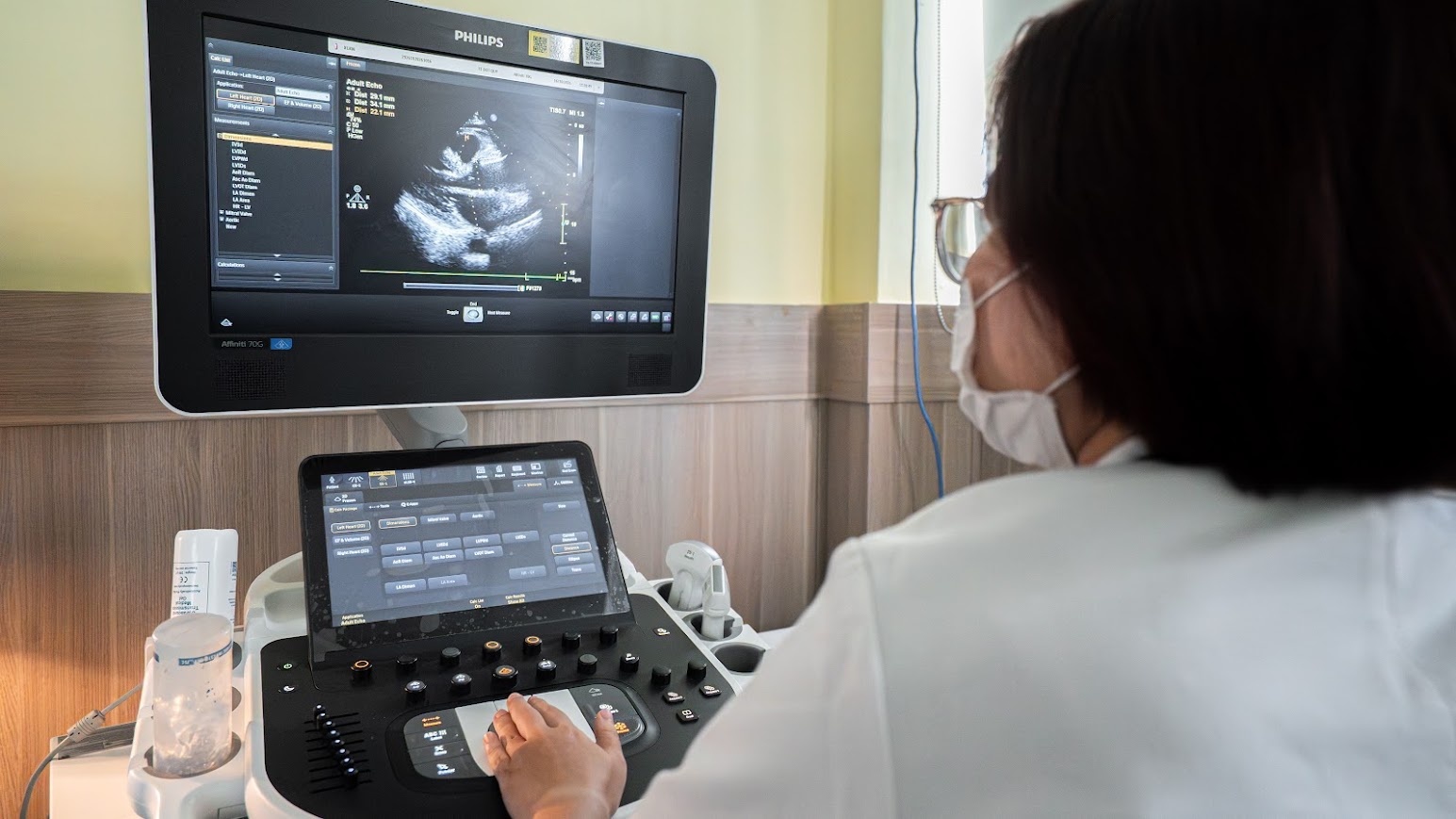 đột quỵ ảnh 21 đột quỵ ảnh 21