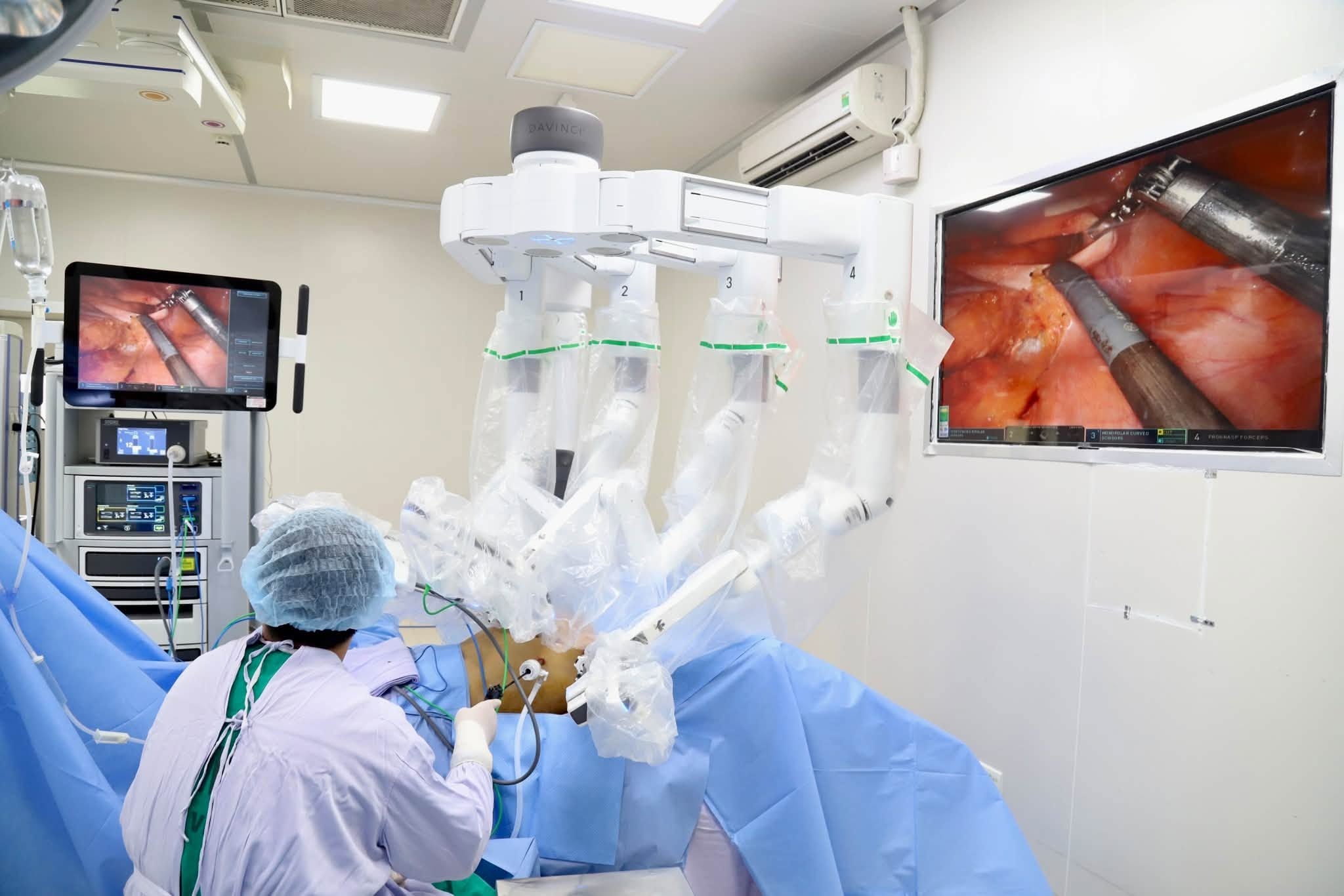 ung thư ảnh 2