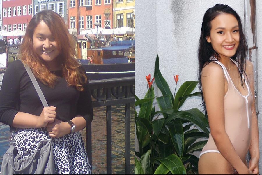 Ban co biet: Giam can la cach phau thuat tham my hieu qua nhat hinh anh