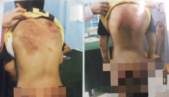 be trai 11 tuoi bi bao hanh anh 1