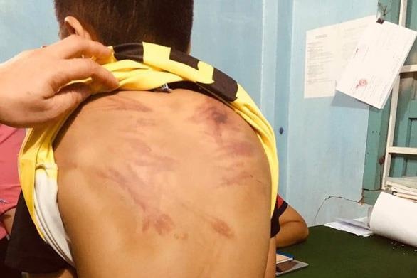 Be trai 11 tuoi bi bao hanh am anh moi khi di ngang chua hinh anh