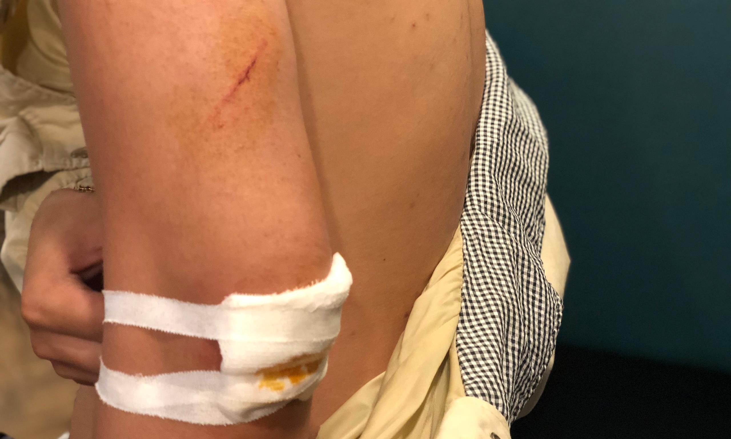 Hai Viet kieu bi nhan vien giu xe hanh hung o Sai Gon hinh anh