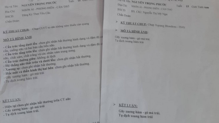 Hoc sinh lop 9 bi bao ve truong danh gay xuong ham anh 2