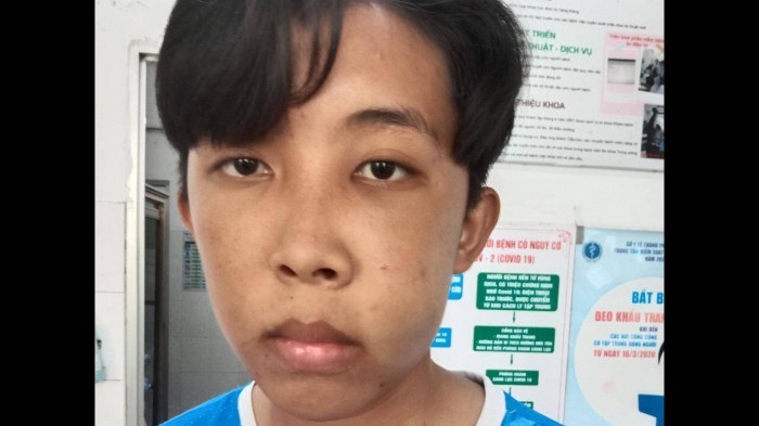 Hoc sinh lop 9 bi bao ve truong danh gay xuong ham anh 3