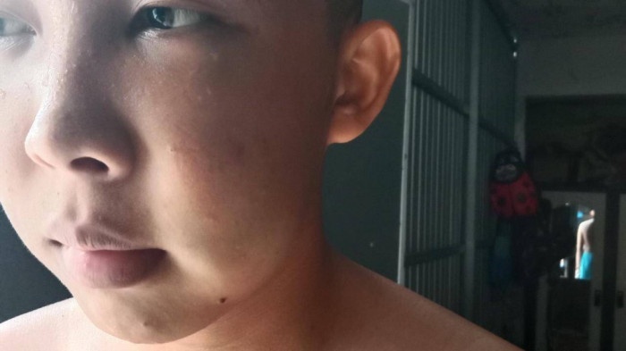 Hoc sinh lop 9 bi bao ve truong danh gay xuong ham hinh anh