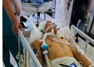 Bi dam do va cham giao thong, nam thanh nien tu vong sau mot thang hinh anh