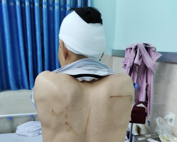 Nguoi dan ong bi chem truoc cong benh vien o Hai Phong hinh anh