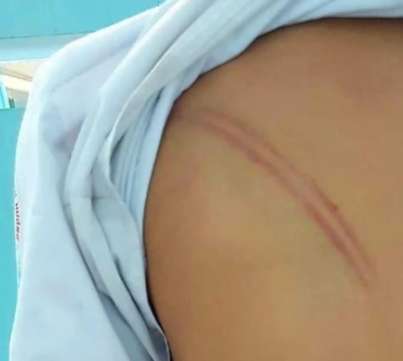 Chu tich tinh Ca Mau chi dao ‘nong’ vu me ke danh con chong hinh anh