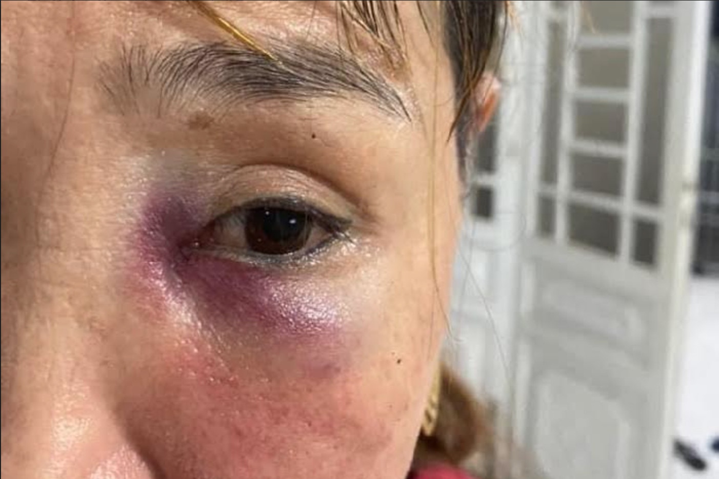 Nu chu quan mi Quang bi hanh hung bam tim mat hinh anh