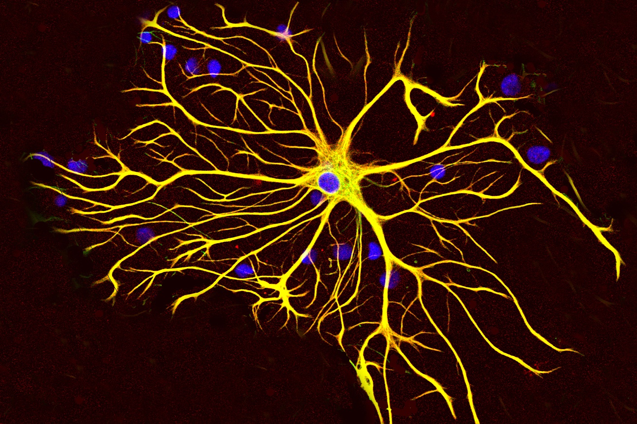Khoa hoc phat hien gen 'zombie' trong nao nguoi moi qua doi hinh anh