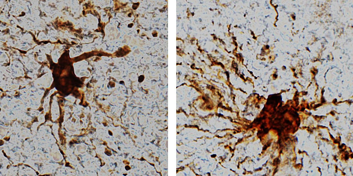 gen zombie trong nao nguoi anh 1