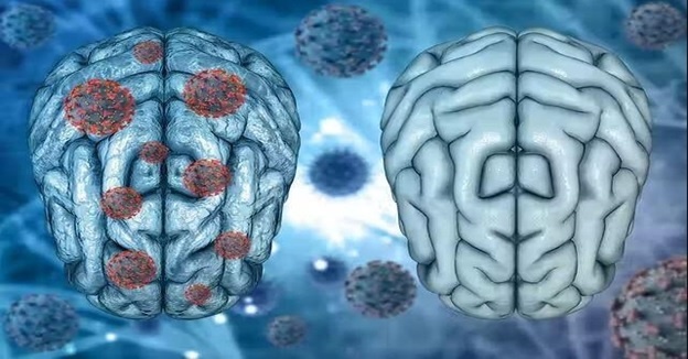 Hien tuong nhieu F0 gap phai hau Covid-19 hinh anh