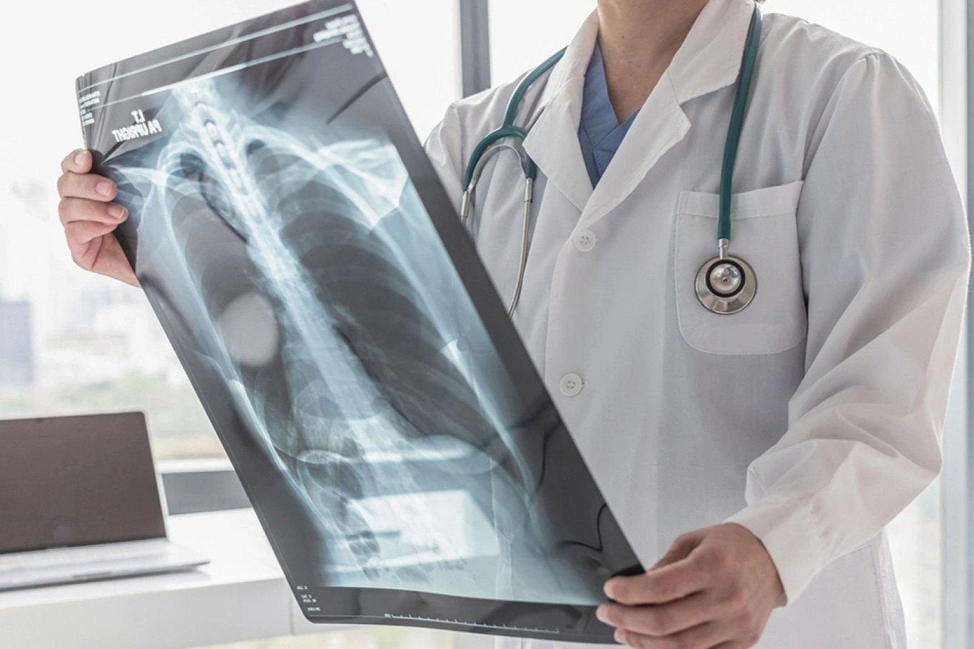 Nguoi dan ong mac benh ly hiem gap o phoi hinh anh