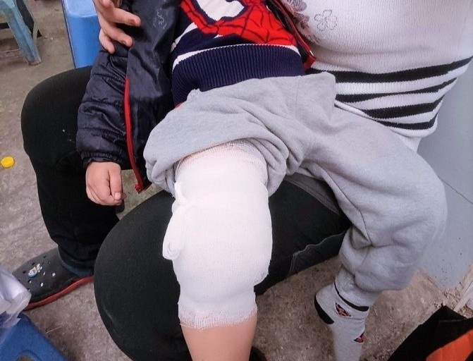 Tre 3 tuoi bi gay chan sau khi di hoc, phu huynh yeu cau lam ro hinh anh