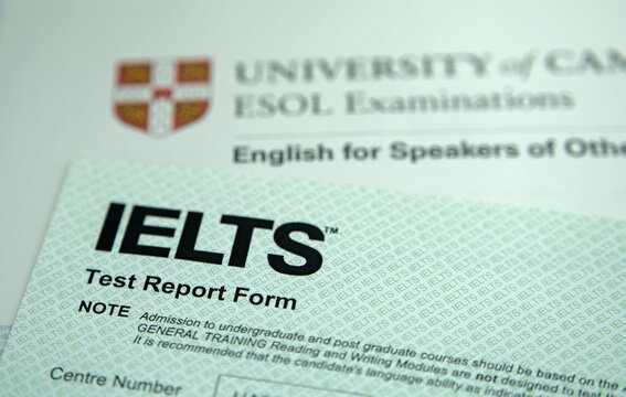 Muc quy doi diem IELTS cua hon 25 dai hoc hinh anh