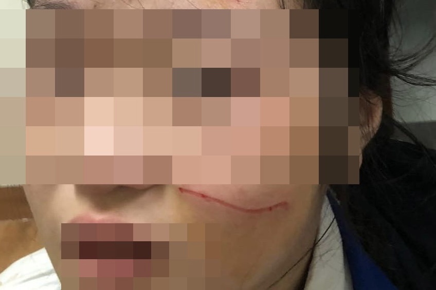 Ky luat hoc sinh danh ban chay mau, rach mat o Ha Dong hinh anh