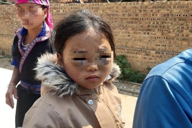 Giao vien go thuoc len dau khien hoc sinh Yen Bai tim mat hinh anh