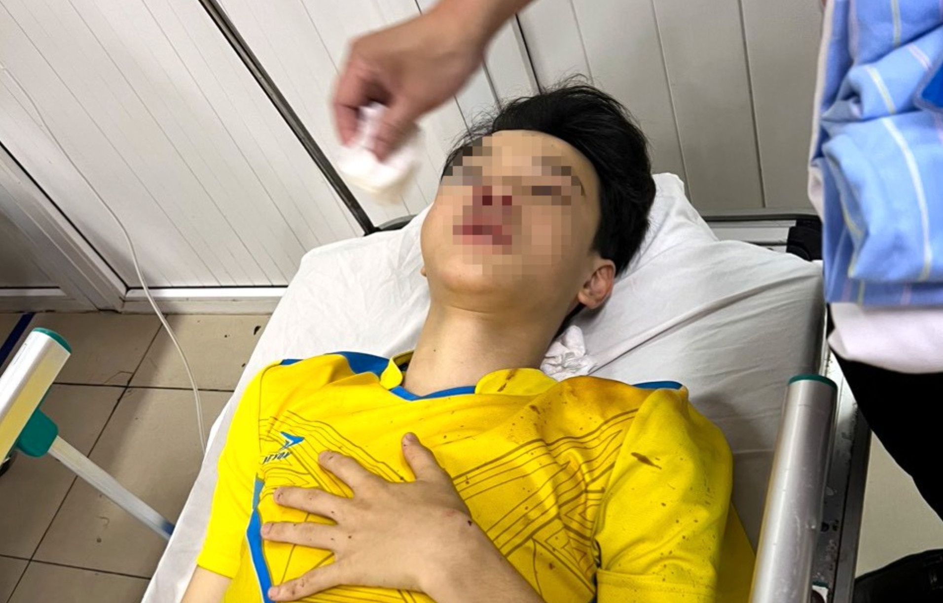 Tren duong di thi lop 10, nam sinh bi tai nan phai bo thi hinh anh