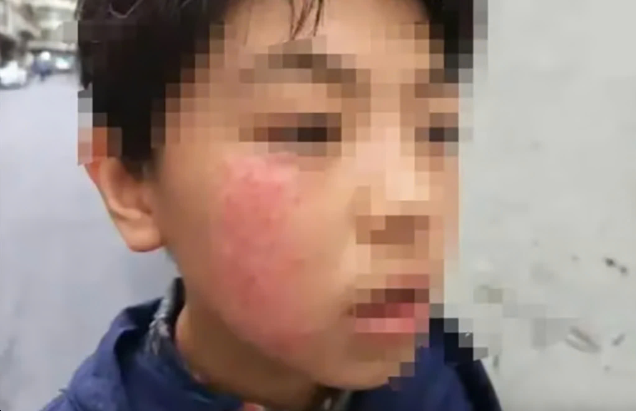 Phu huynh o Trung Quoc to giao vien tat tre khien da bi mat sac to hinh anh