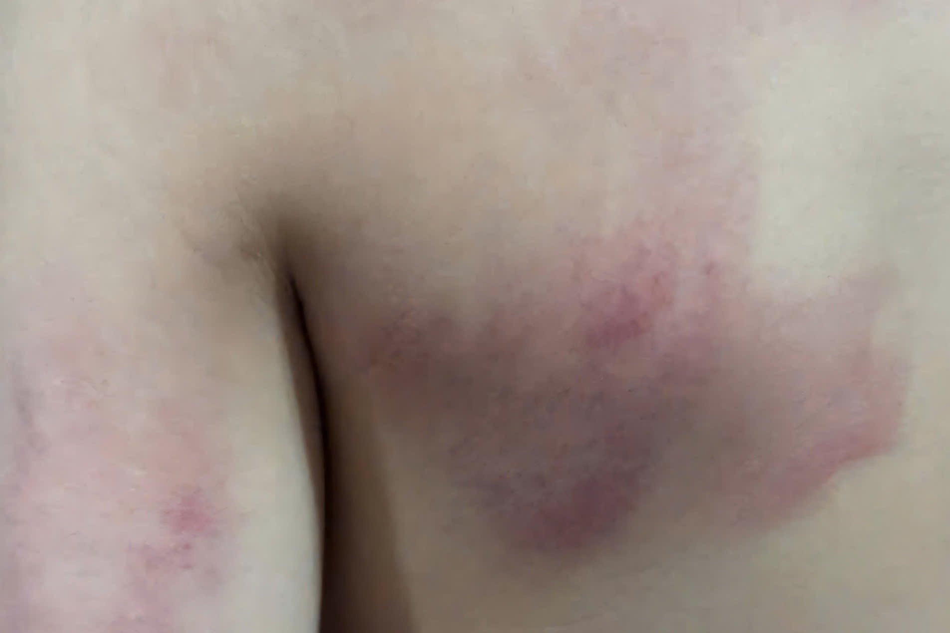 Danh hoc sinh lop 2 bam lung, giao vien bi dinh chi cong tac 3 thang hinh anh