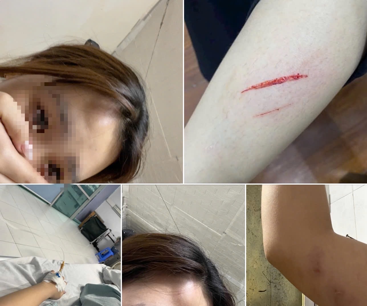 Cong an xac minh vu nu sinh vien bi hanh hung vi tien bo hinh anh