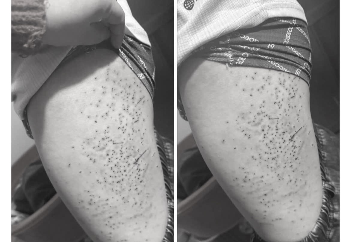 Hoc sinh lop 7 bi ban dung but bi dam chi chit vao dui hinh anh