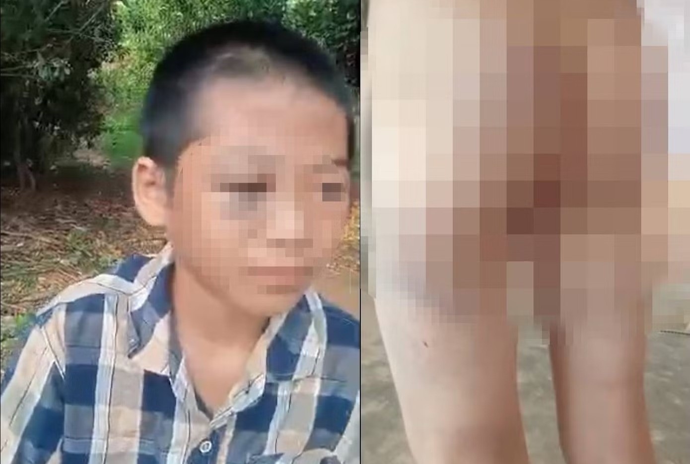 Xon xao clip hoc sinh lop 6 nghi bi nguoi than bao hanh hinh anh