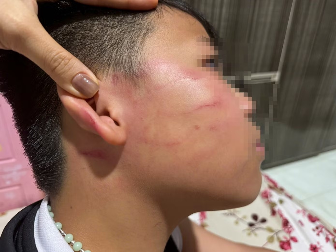 Vu giao vien nuoc ngoai tat hoc sinh: Gia dinh noi be trai bi thung mang nhi hinh anh