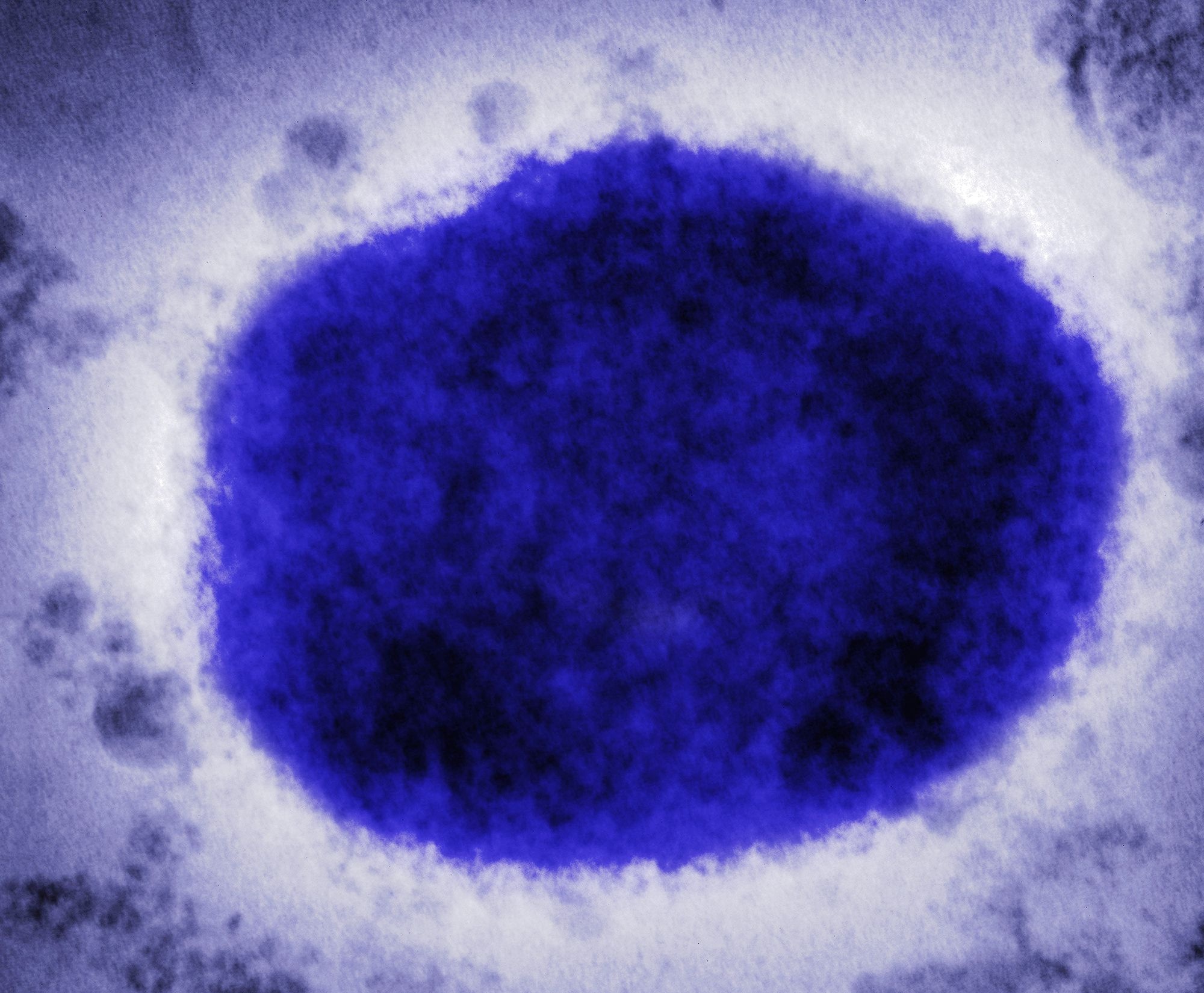 WHO Viet Nam khuyen cao ve trieu chung dau mua khi hinh anh