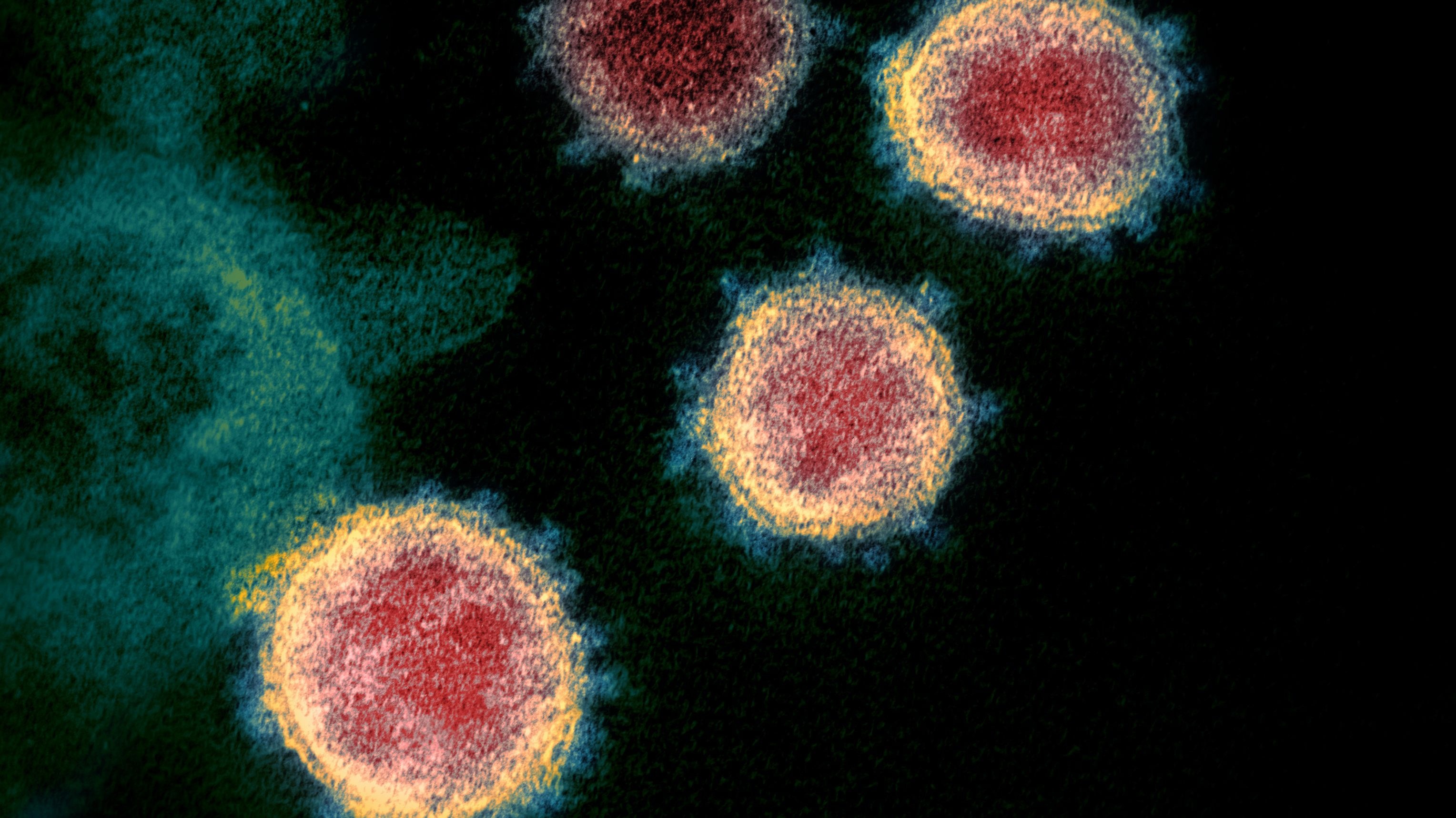 Bien chung moi gay chu y tai My hinh anh