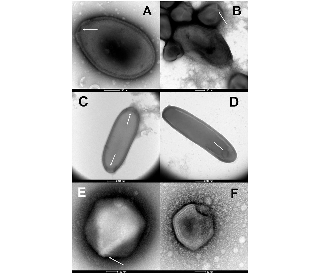 virus xac song co dai anh 2