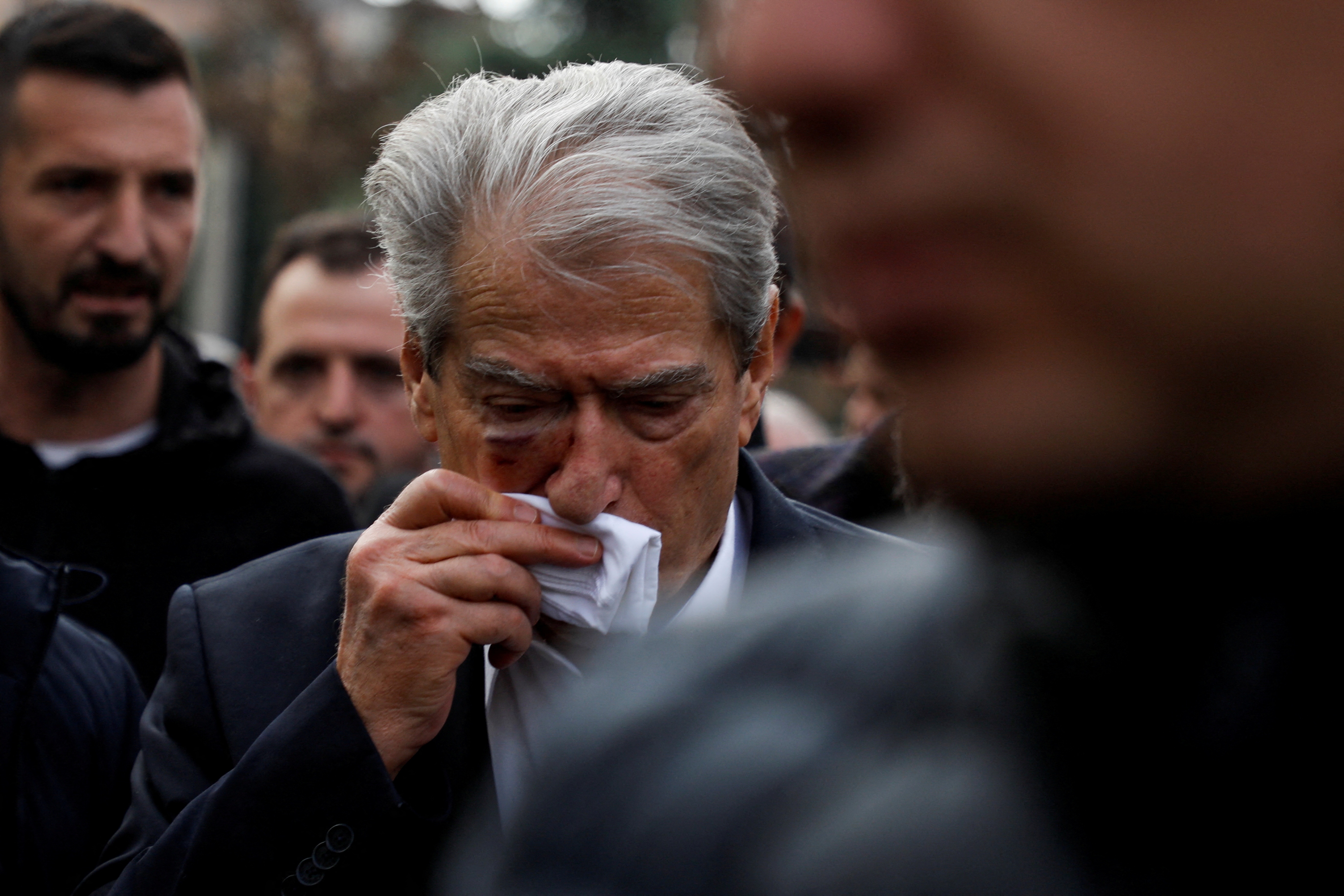 Cuu tong thong Albania bi dam vao mat hinh anh