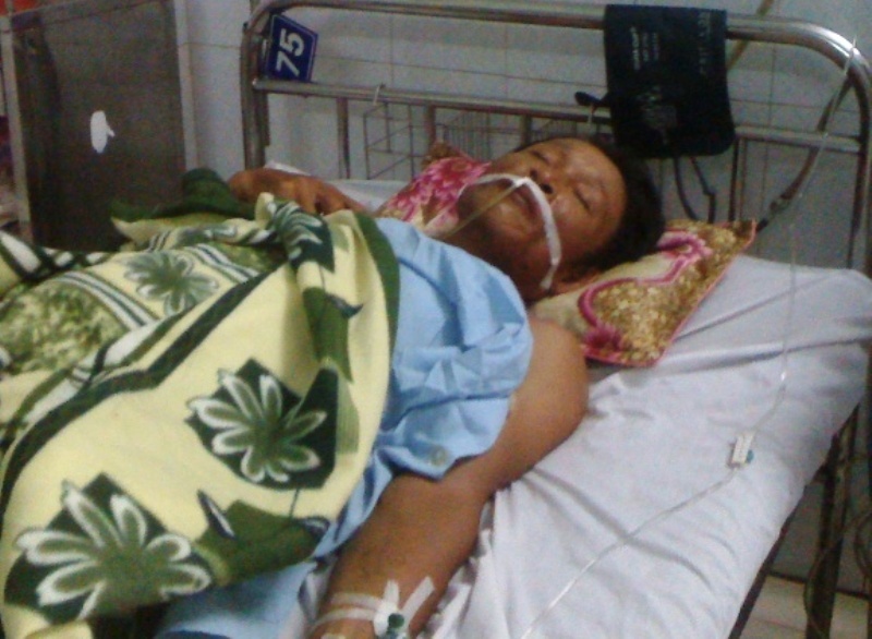 Hai thanh nien xuong tay sat hai lai xe om roi bo tron hinh anh