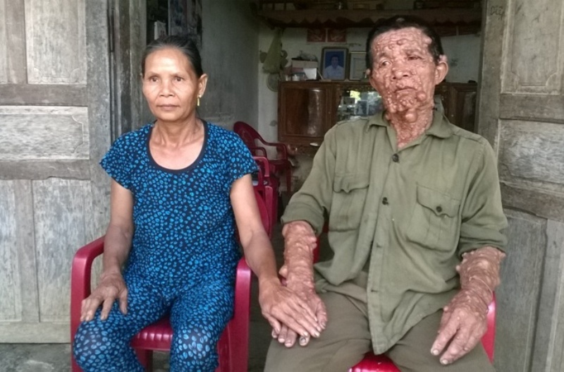 Hai moi tinh cua nguoi dan ong moc u khap co the hinh anh