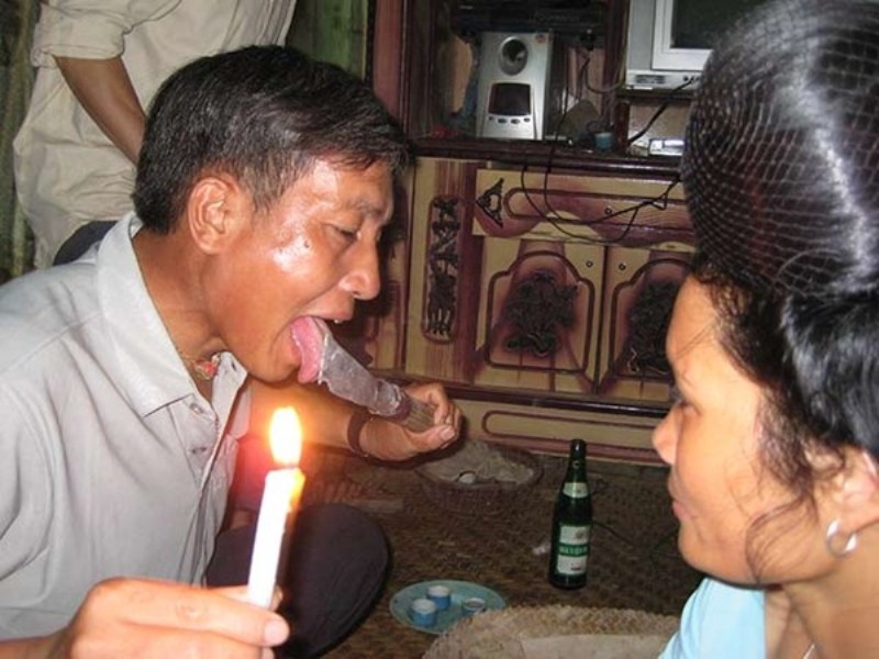 Kieu chua benh ky quai: Doc than chu chua lanh vet thuong hinh anh