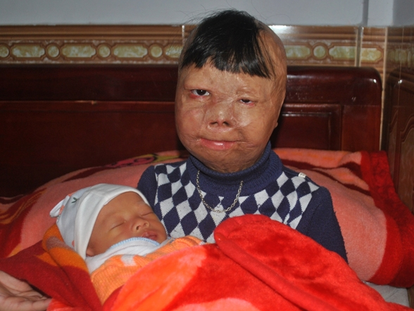 Be trai bi bo tam xang dot mo uoc thanh bac si hinh anh