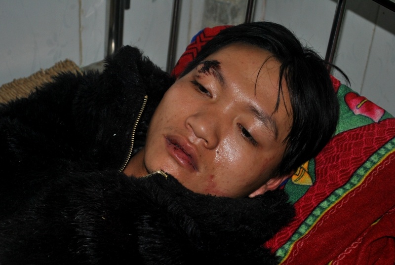 Nguoi nghi la cau tac ke lai phut bi danh hoi dong hinh anh