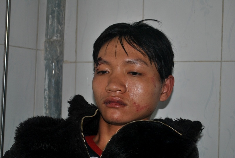 50 nguoi bi trieu tap vu nghi pham trom cho bi danh chet hinh anh