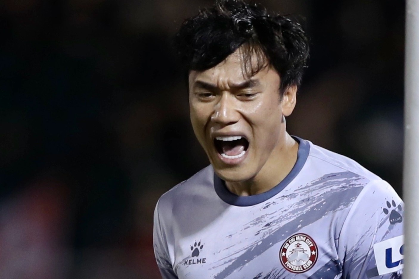 Bi kich cua CLB TP.HCM hinh anh