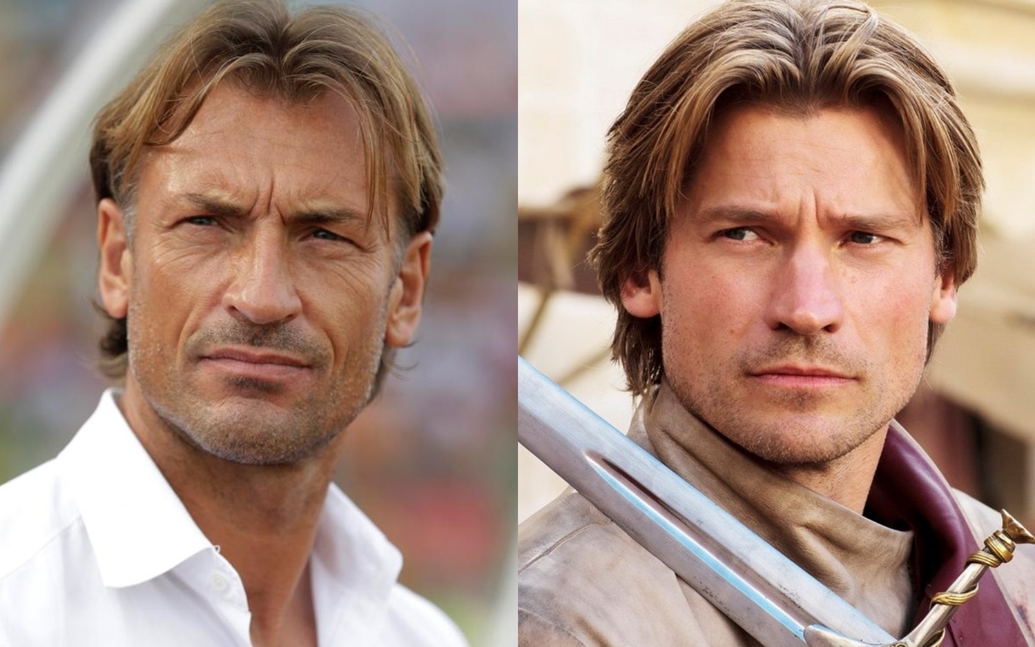 ve dien trai cua hlv herve renard anh 2