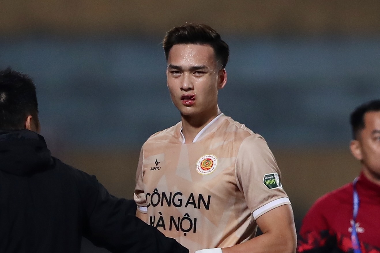 Bui Hoang Viet Anh phai khau 24 mui hinh anh